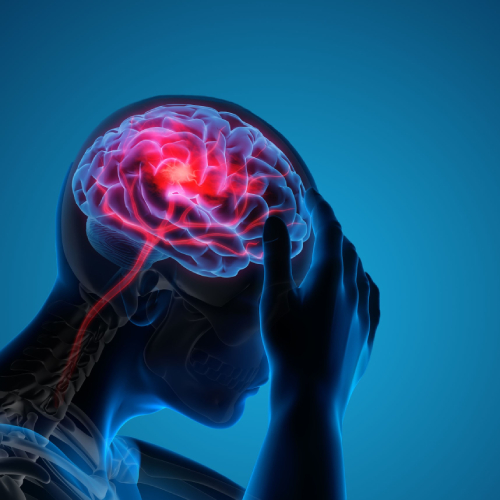 Friedreich's Ataxia Image